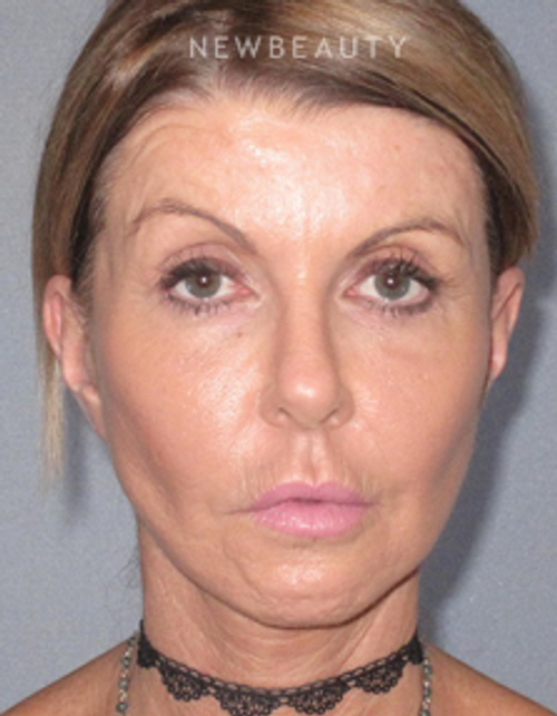 Dr. German Newall - Refreshed Look - After