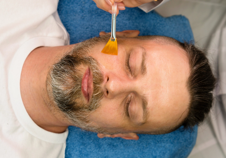 A man receiving a professional chemical peel treatment, eyes closed, as a practitioner applies solution to his face with a brush in a clinical setting.A man receiving a professional chemical peel treatment, eyes closed, as a practitioner applies solution to his face with a brush in a clinical setting.