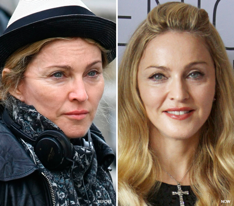 Madonna