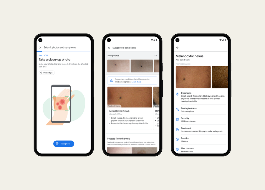 Google’s New AI-Powered Tool Might Help Assess Skin Conditions