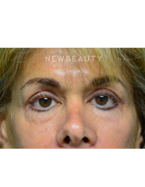 Dr. B. Aviva Preminger - A Bright New Look - After