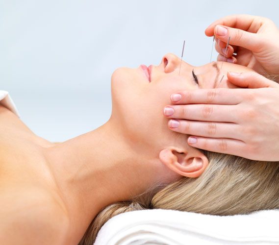 Acupuncture