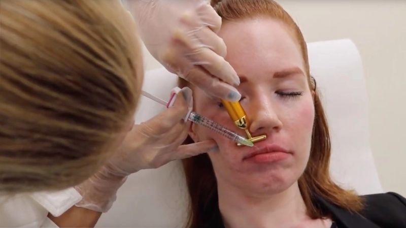 Dr. Russak: Volbella for Even Lips