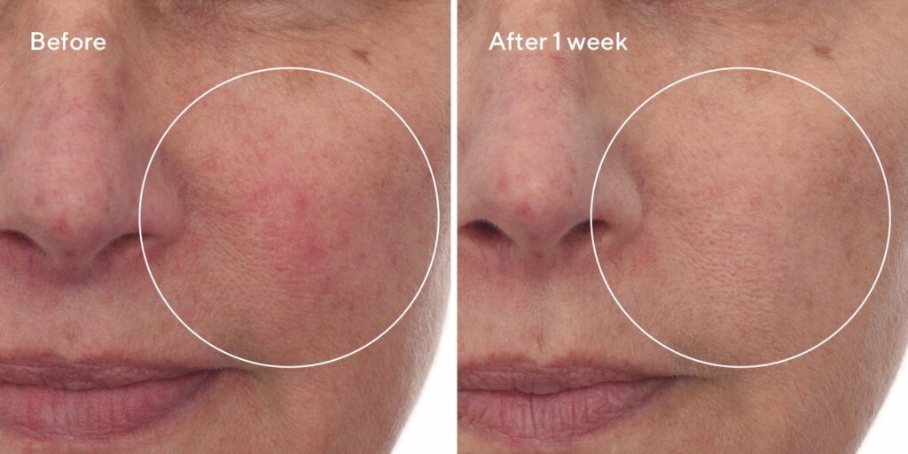 murad-before-and-after