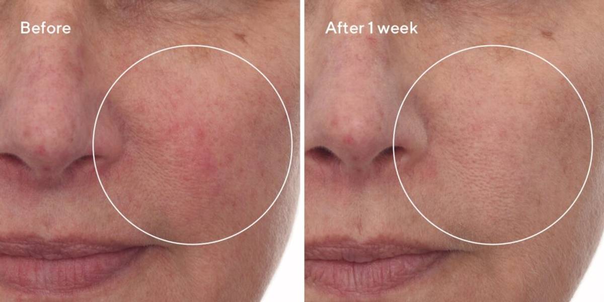 murad-before-and-after