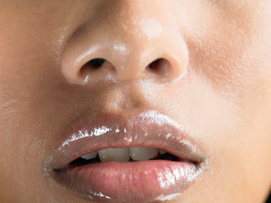 Our Noses Droop As We Age, But Is There a Way To Stop It?