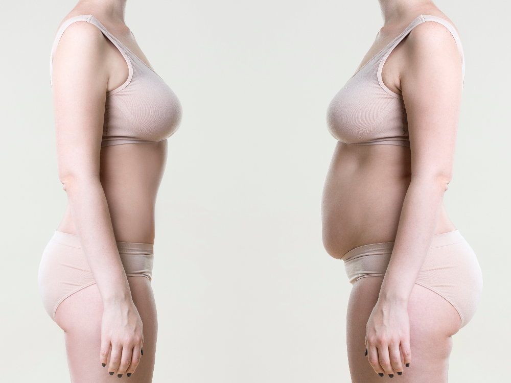 The Expert-Approved Guide to a Mommy Makeover: What You Need to Know