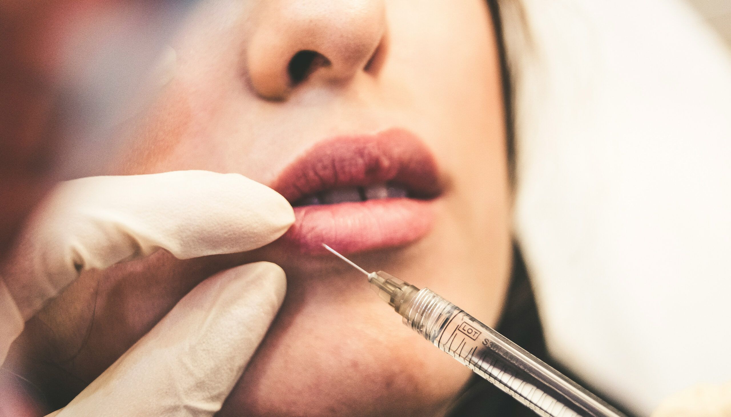woman getting lip filler