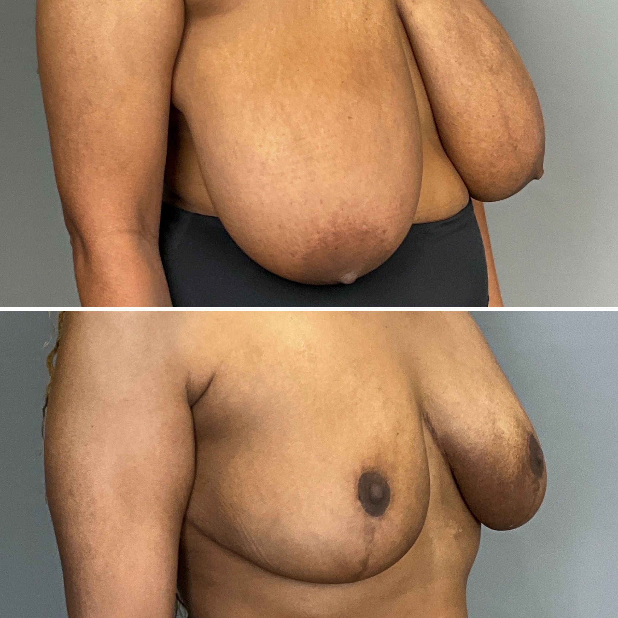 Louisville, KY plastic surgeon Chet Mays, MD