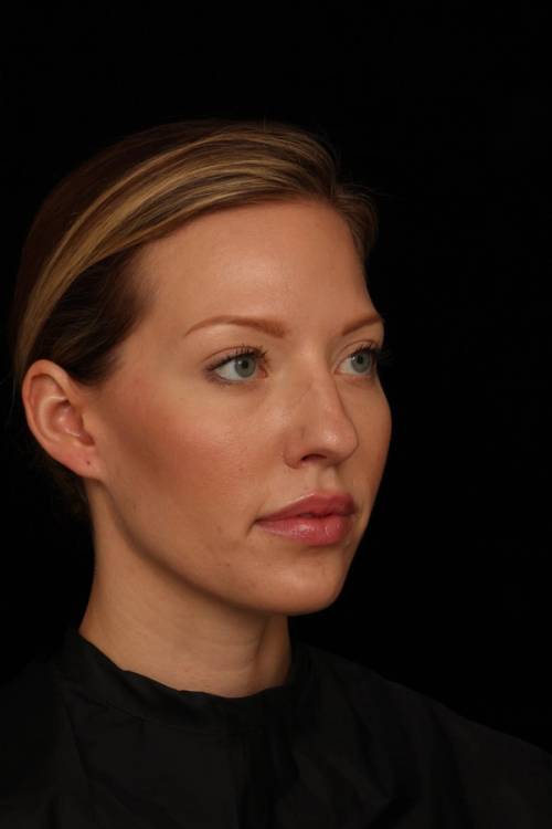 Dr. Jennifer M. Segal - Brighter Appearance - After