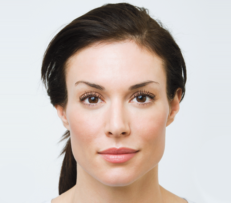 Lighten Heavy Folds: Do It with Fillers or Fat