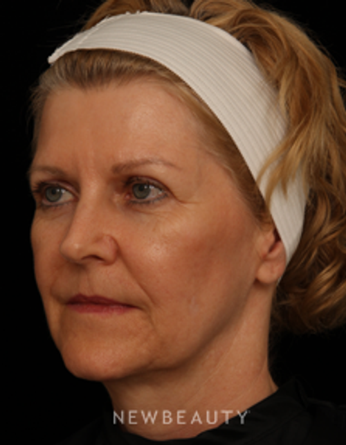 Dr. Jennifer Segal - Reason to Smile - After