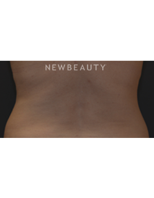 Dr. Janet Allenby - Feminine Curves - After