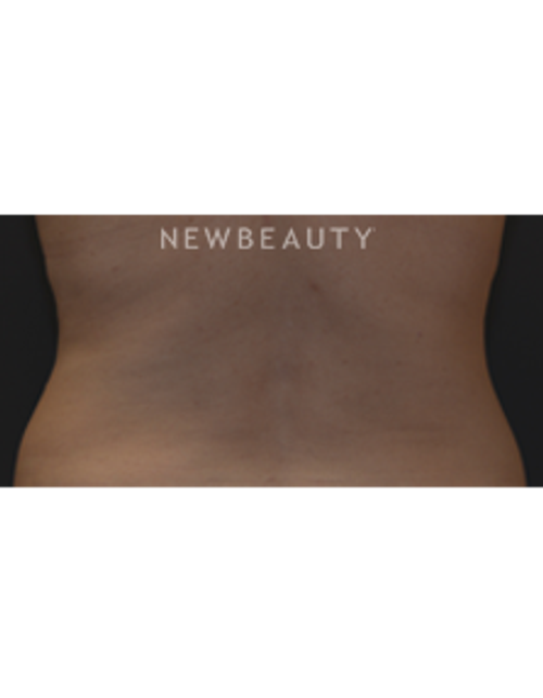 Dr. Janet Allenby - Feminine Curves - After