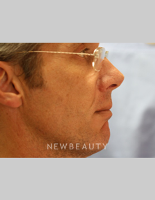 Dr. Bob Perkins Orthodontics - After