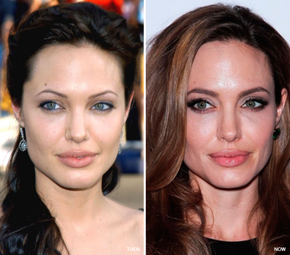 Tip 12: Rehabilitate weak brows