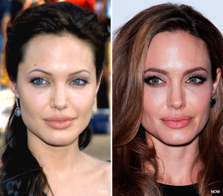 Tip 12: Rehabilitate weak brows