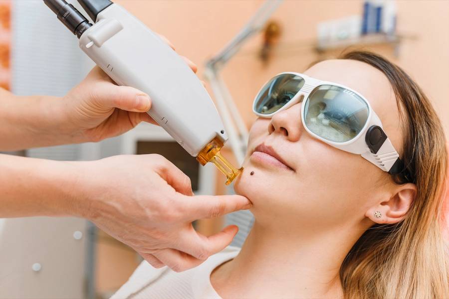 laser treatment