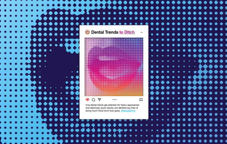 Graphic featuring a mock Instagram post titled “Dental Trends to Ditch,” set against a blue-and-purple halftone background, with a colorful abstract mouth image and text warning that viral dental trends may do more harm than good.