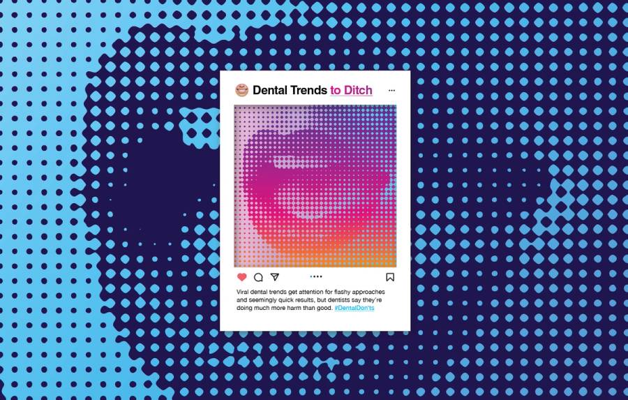 Graphic featuring a mock Instagram post titled “Dental Trends to Ditch,” set against a blue-and-purple halftone background, with a colorful abstract mouth image and text warning that viral dental trends may do more harm than good.