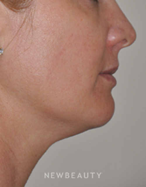 Dr. Bryan W. Gawley - No Downtime - After