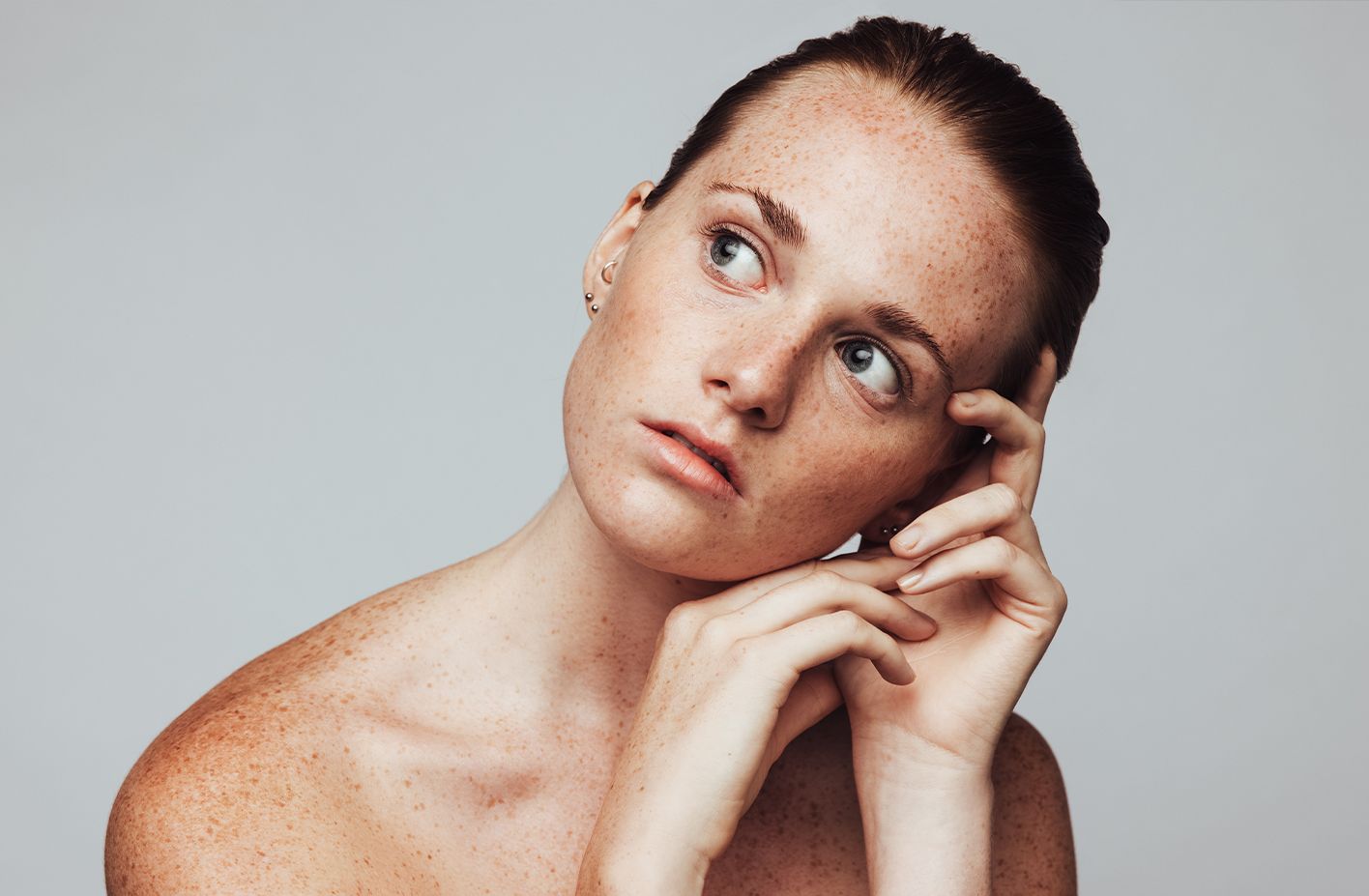 Can Adult Acne Signal Something More? Exploring the Acne and PCOS Connection