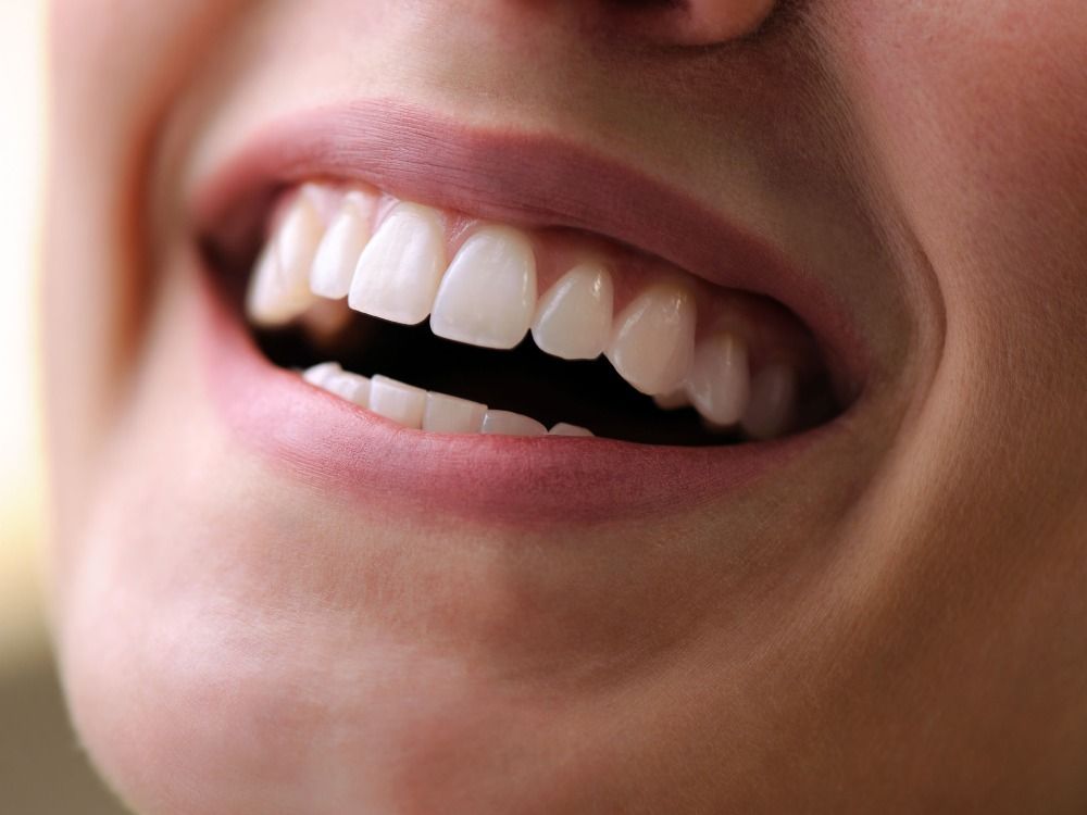 The Life-Changing Art of Implant Dentistry