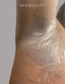 Dr. Anna Chacon - Skin Infection - 34279887 - Before