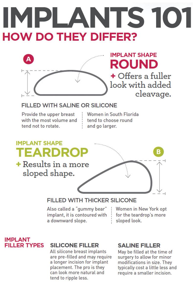 Infographic Implants101