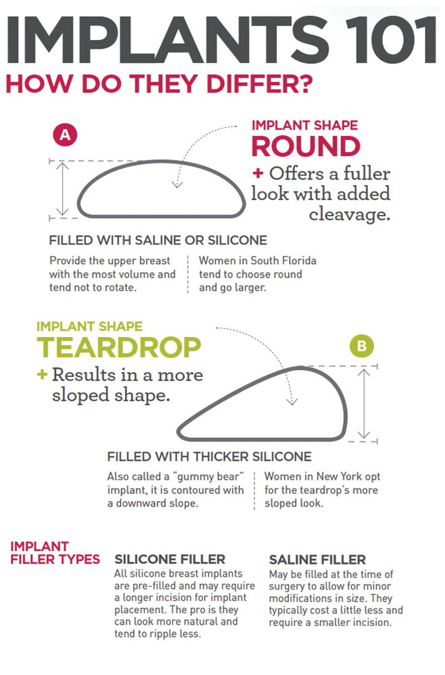 Infographic Implants101