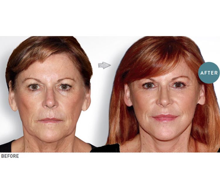 Refreshed + Rejuvenated