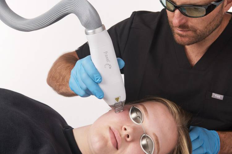FAVORITE LASER TREATMENT FOR SUN DAMAGE