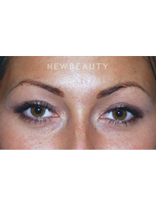 Dr. Roman Rayham - Youthful Outlook - After