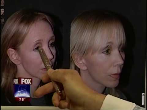 Dr. Jacono – A New York Revision Rhinoplasty Specialist