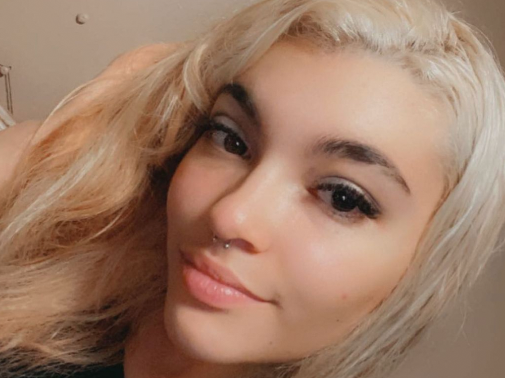 This Woman Developed a Sensitivity to Hair Dye And Her Allergic Reaction Is Terrifying