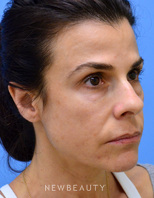 Dr. Mokhtar Asaadi - Matching Aesthetics - Before