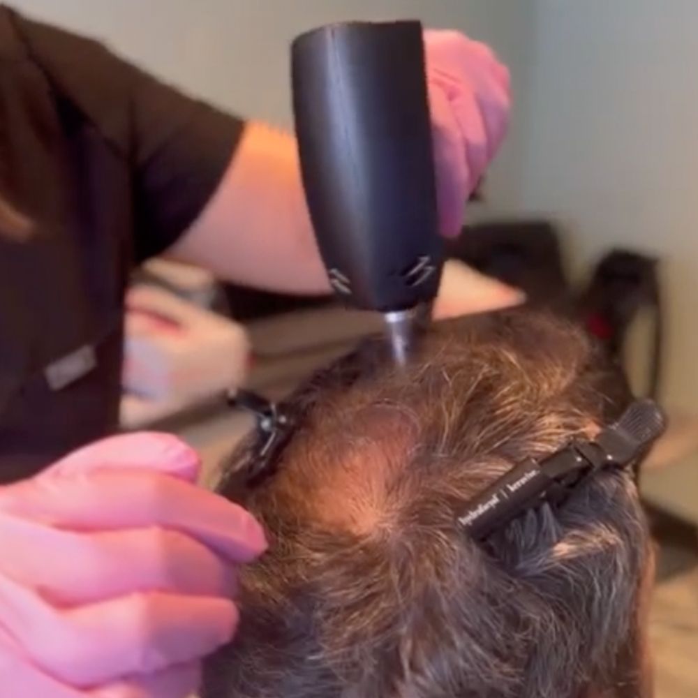 The Hair-Growth Helper