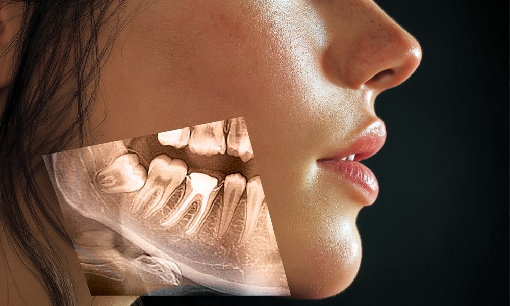 I PROMPT (ALL): A SIDE PROFILE OF A WOMAN, NATURAL LIGHTING AND LIGHT BACKGROUND, ULTRA-DETAILED, ULTRA-DETAILED, 8K, PHOTOREALISTIC, ANATOMICAL PRECISION