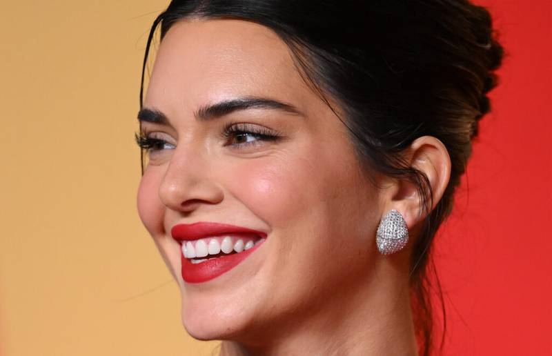 kendall jenner acne
