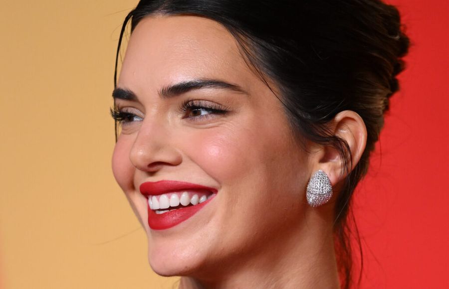 kendall jenner acne