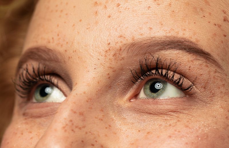 Under the Radar Botox Uses