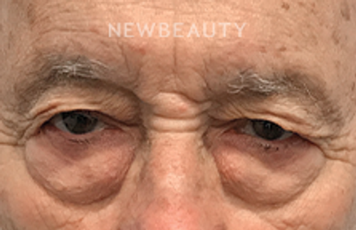 Dr. David Schlessinger - Turning Back the Clock - Before