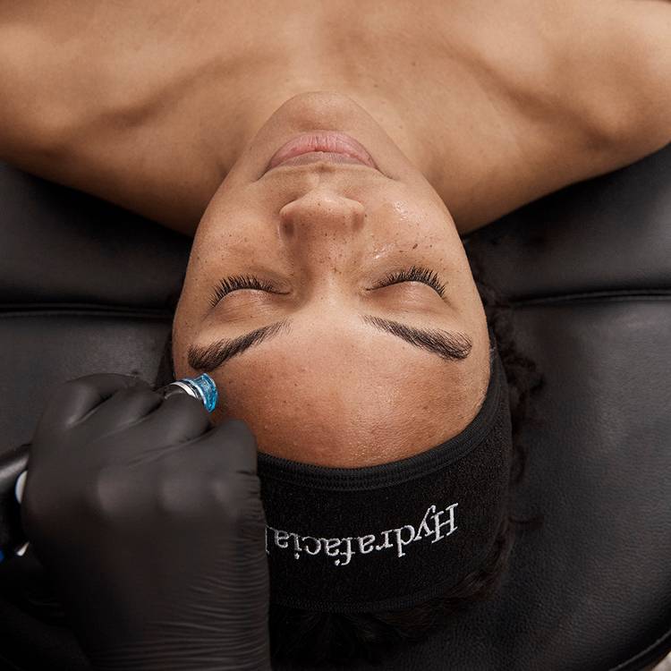 Hydrafacial