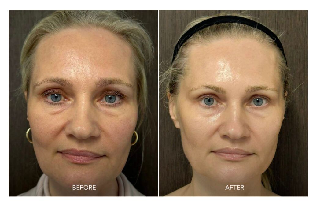 SKORR GLOW BEORE AND AFTER