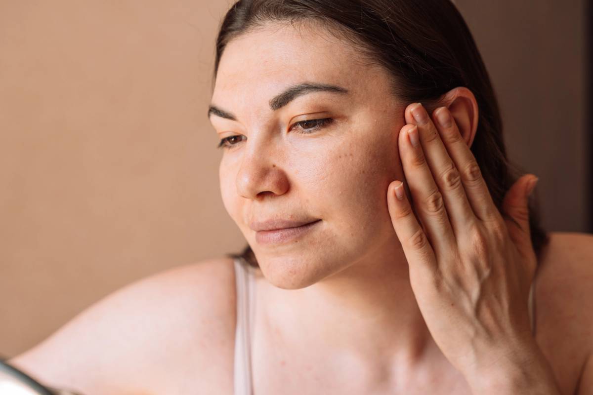 Acne Is More Than the Breakout—Here’s How to Treat It at Every Stage