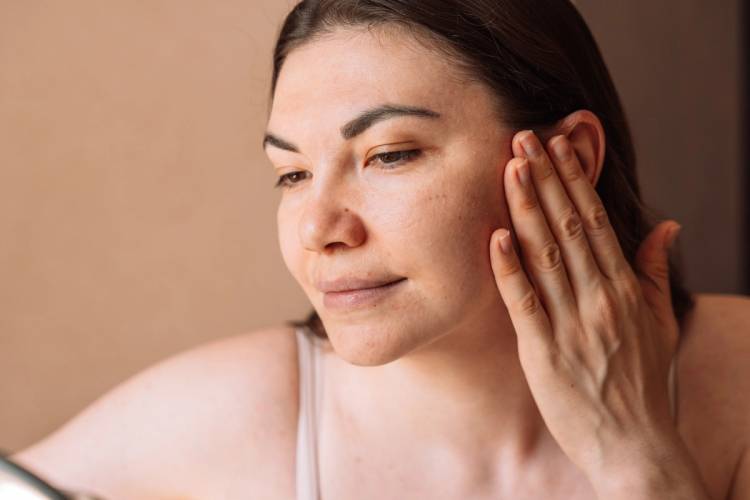 Acne Is More Than the Breakout—Here’s How to Treat It at Every Stage