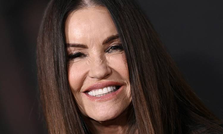 Janice Dickinson Reveals Deep Plane Facelift and Brow Lift Results at 71