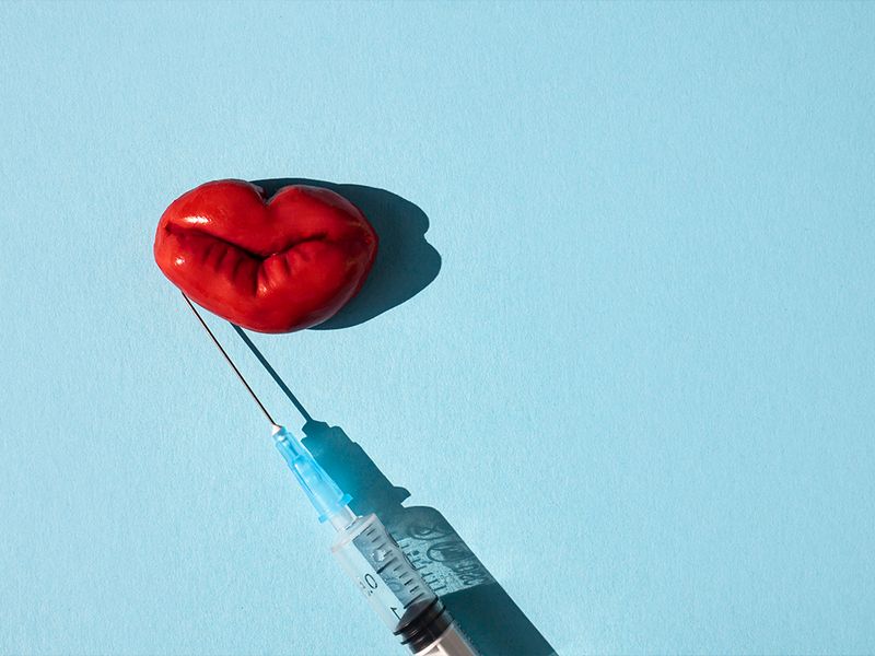 Common Filler Mistakes That Lead to an Overfilled Look