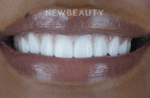Dr. Robert Klaich - Stunning Transformation - 22247240 - After