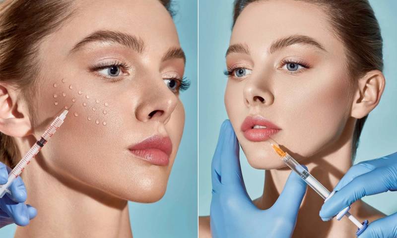 side by side images of woman getting cosmetic injections in her face